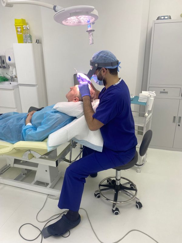 Dr Ahmad Moussa Hair Transplant Nottingham
